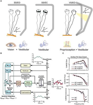 Postural impairments in unilateral and bilateral vestibulopathy